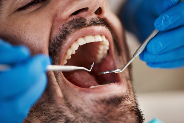 Best Dental X-Rays and Imaging  in Lake Wildwood, CA